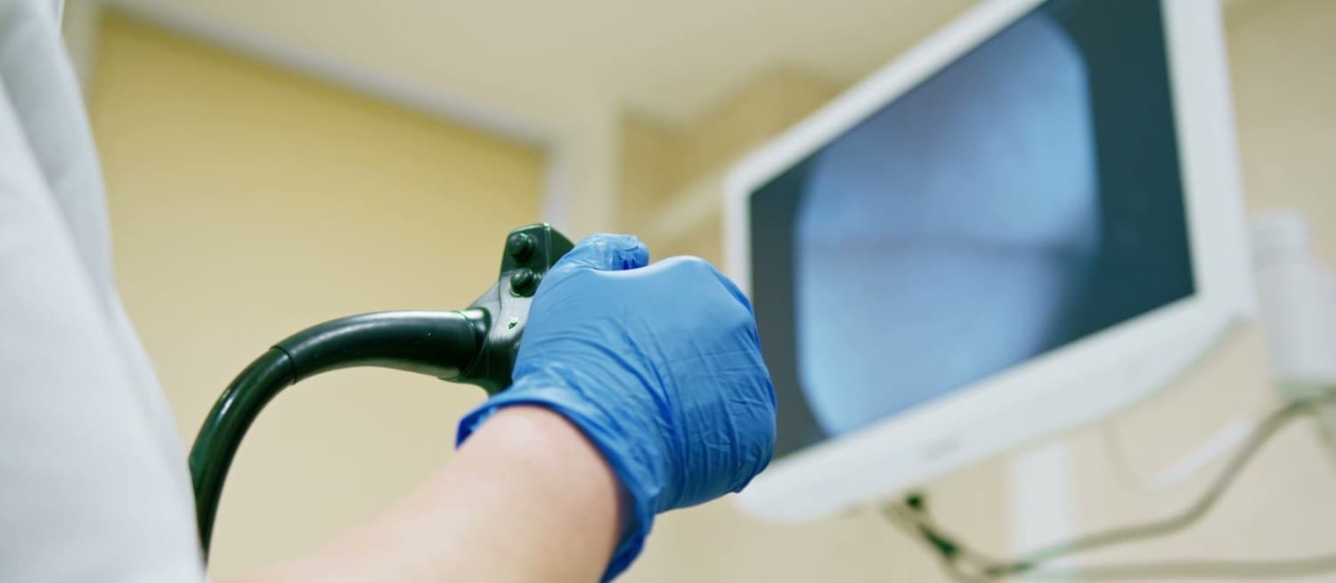 A gloved hand on the control head of a colonoscope, with the endoscopy monitor showing the bowel lining behind it.