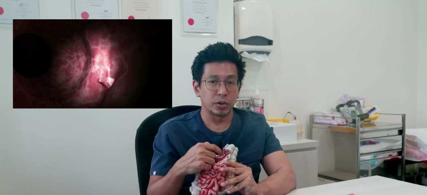 Dr Sulaiman Bin Yusof seated at his clinic desk holding an anatomical model of the intestines in both hands, with an inset at the upper left showing real colonoscope footage of the pink vascular lining inside a colon.