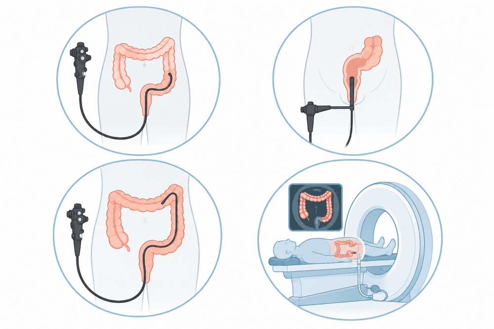 Four medical illustrations of the tests that examine the large bowel. Two show a flexible colonoscope passed through the colon, one shows a shorter scope examining the rectum, and the fourth shows a patient lying on a CT scanner table while the colon is imaged, with the scan displayed on a monitor.