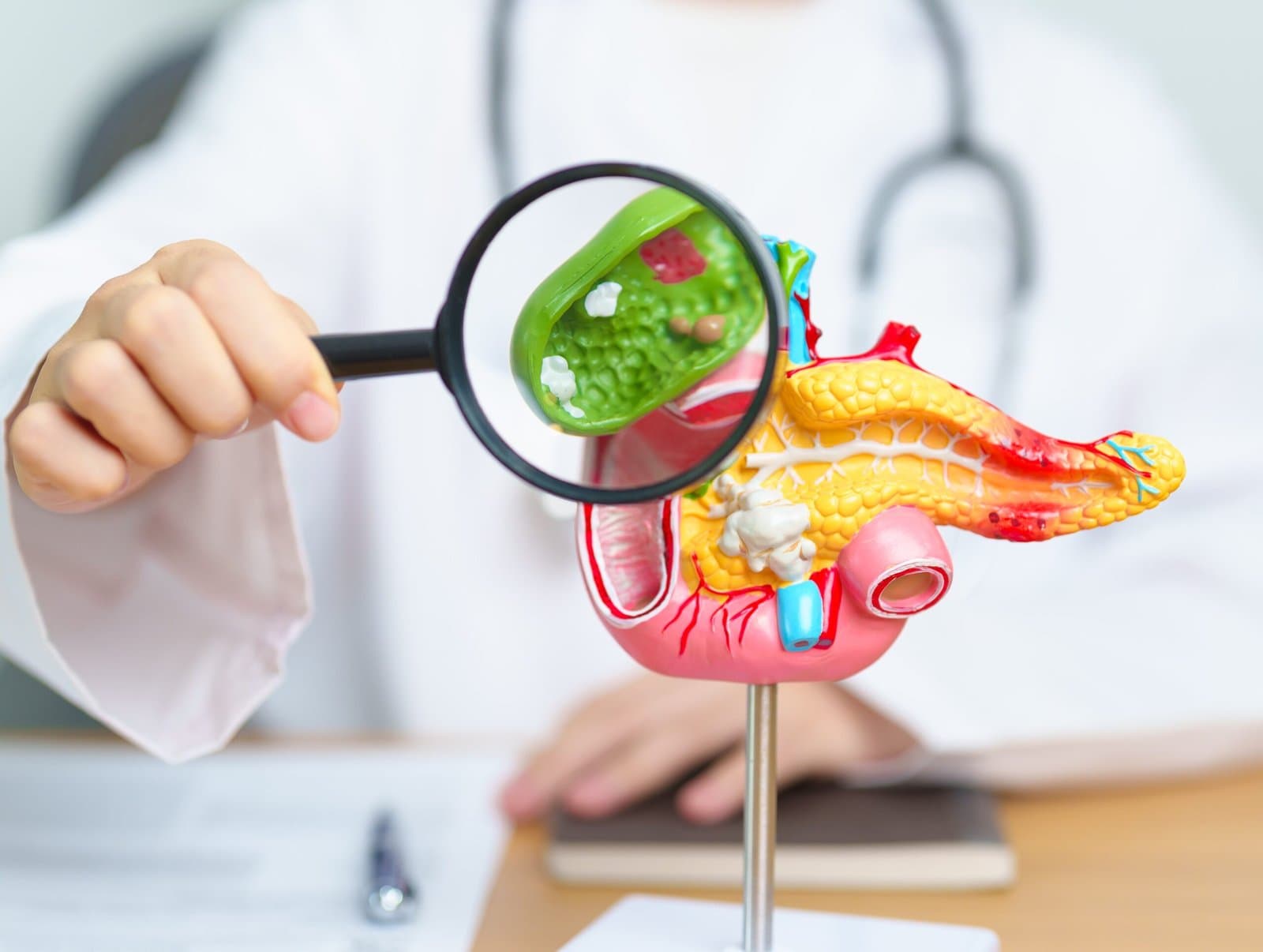 An anatomical model of the gallbladder opened to show stones inside it, with a magnifying glass held over them.
