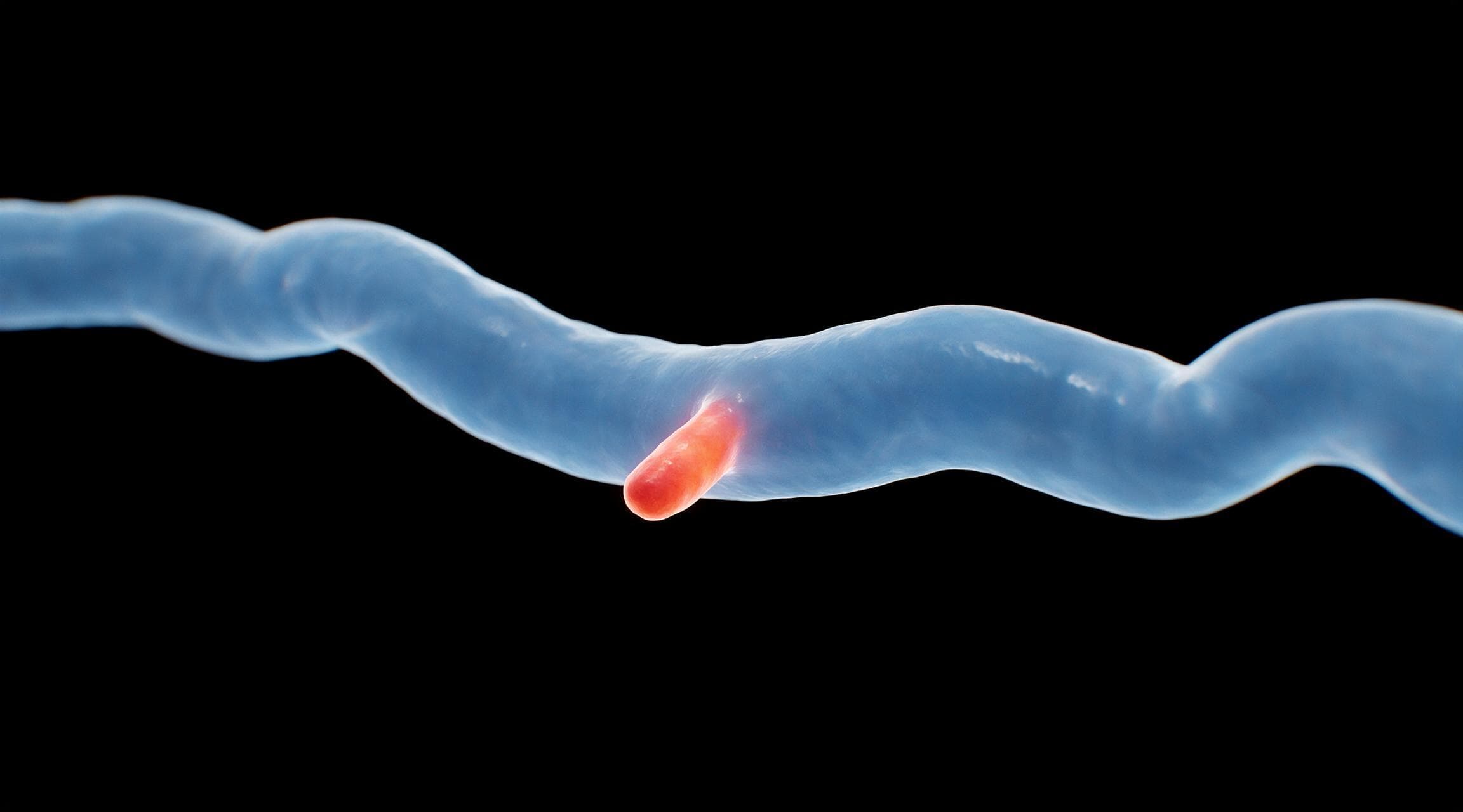 A length of small intestine running across a black background in translucent pale blue. A single small blind-ended pouch protrudes from one side of the bowel wall, lit orange. Nothing else along the bowel is highlighted.